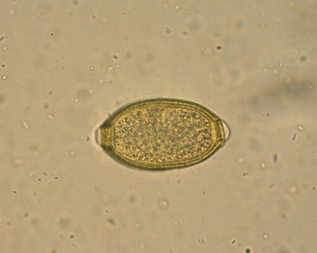 Haarwürmer_Haarwurmei_Kohls